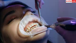 Root Canal Benefits: सिर्फ दांत ही नहीं बचाता रूट कनाल, इन बीमारियों से भी दिलाता है राहत