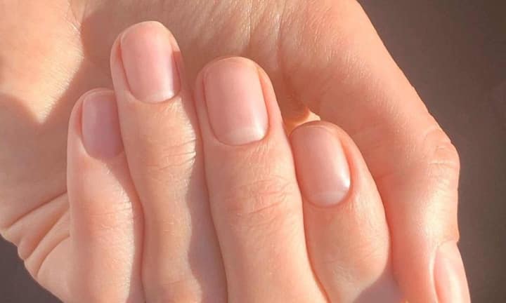 क्लबसिंग एक ऐसा बदलाव है, जिसमें उंगलियों के सिर गोल हो जाते हैं और नाखून आगे की ओर ज्यादा घुमावदार दिखने लगते हैं. एक्सपर्ट्स बताते हैं कि ऐसा तब होता है जब शरीर मेगाकैरियोसाइट्स फेफड़ों को बाईपास कर उंगलियां तक पहुंच जाते हैं और वहां ग्रोथ फैक्टर रिलीज करते हैं. यह बदलाव अक्सर क्रॉनिक लंग डिजीज जैसे फेफड़ों का कैंसर सिस्टिक फाइब्रोसिस, पल्मोनरी फाइब्रोसिस, ब्रोन्किइक्टेसिस या लंबे समय तक कम ऑक्सीजन वाली स्थितियों जैसे हार्ट डिजीज में देखा जाता है. ऐसे में अगर उंगलियां अचानक मोटी और गोल लगने लगे तो तुरंत डॉक्टर से जांच करनी चाहिए. 