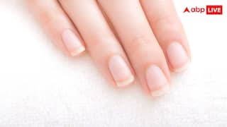 हाथों-नाखूनों में दिखने वाले ये 5 बदलाव हो सकते हैं गंभीर बीमारी का संकेत, डॉक्टर्स ने दी चेतावनी