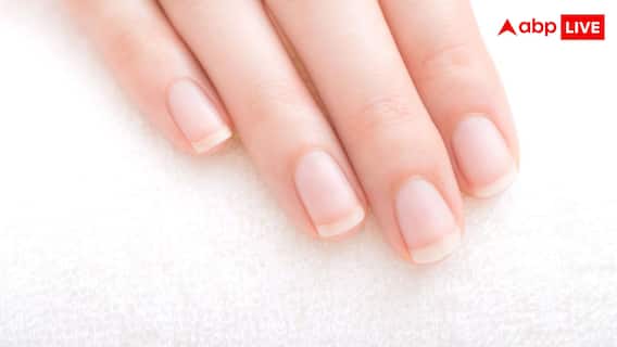 हाथों-नाखूनों में दिखने वाले ये 5 बदलाव हो सकते हैं गंभीर बीमारी का संकेत, डॉक्टर्स ने दी चेतावनी