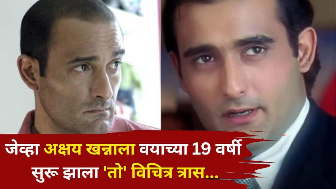 Akshay Khanna: 'तेव्हा सर्वच उद्ध्वस्त झाल्याचं वाटलं' जेव्हा अक्षय खन्नाला वयाच्या 19 वर्षात सुरू झाला 'तो' विचित्र त्रास, अभिनेत्याने स्पष्टच सांगितलं... Akshay Khanna entertainment marathi news When Akshay Khanna went bald at the age of 19 actor revealed the whole situation Akshay Khanna: 'तेव्हा सर्वच उद्ध्वस्त झाल्याचं वाटलं' जेव्हा अक्षय खन्नाला वयाच्या 19 वर्षात सुरू झाला 'तो' विचित्र त्रास, अभिनेत्याने स्पष्टच सांगितलं...