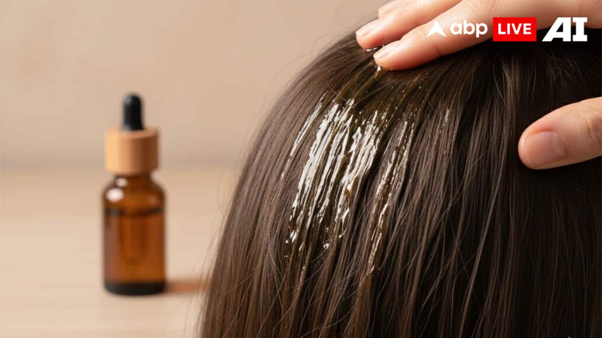 Why Dandruff Peaks In Winter And The Smart Scalp Care That Prevents It