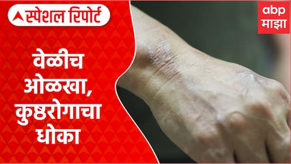 Kushthrog : वेळीच ओळखा, कुष्ठरोगाचा धोका Special Report