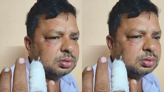 राजस्थान: जयपुर के व्यापारी को कार में बंधक बनाकर लूट, एटीएम से निकाले 2 लाख रुपये