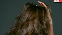 Winter Hair Care: इन 4 दिक्कतों के कारण सिर से कभी दूर नहीं होता डैंड्रफ, क्या आप भी करते हैं ये गलतियां?