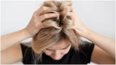 చలికాలంలో చుండ్రు పెరగడానికి కారణాలు ఇవే.. స్కాల్ప్​ను కాపాడుకోవడానికి వీటిని ఫాలో అవ్వండి