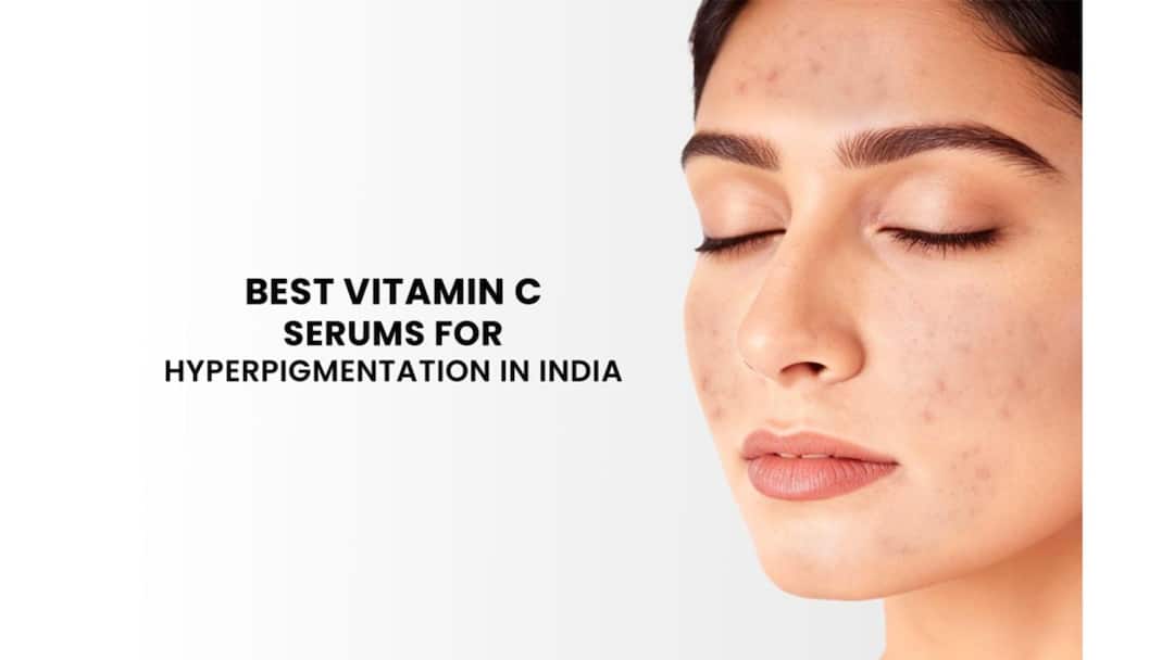 Best Vitamin C Serums for Hyperpigmentation in India Best Vitamin C Serums for Hyperpigmentation in India Best Vitamin C Serums for Hyperpigmentation in India