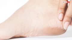 सर्दियों में फटी एड़ियों से हो गए हैं परेशान, तो घर पर ही बनाएं ये बेहतरीन क्रीम