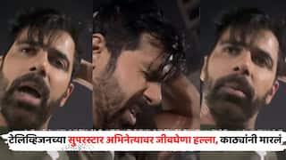 TV Actor Anuj Sachdeva Attacked: 'माझ्या डोक्यातून रक्त येतंय...'; टेलिव्हिजनच्या सुपरस्टार अभिनेत्यावर जीवघेणा हल्ला, लाठ्या-काठ्यांनी मारलं