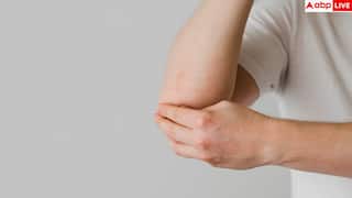 Dark Neck Skin Diabetes: त्वचा का काला पड़ना दे सकता है डायबिटीज का इशारा, जानें कब हो जाएं सतर्क?