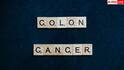 Colon Cancer: युवाओं में ये 5 लक्षण दिखें तो गलती से भी मत करना इग्नोर, वरना बॉडी में घर बना लेगा कोलन कैंसर
