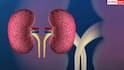 Early Kidney Failure Signs: किडनी फेल्योर के ये 7 लक्षण अक्सर लोग कर देते हैं इग्नोर, नेफ्रोलॉजिस्ट ने बताए बचने के तरीके