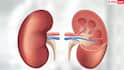 Early Kidney Failure Signs: किडनी फेल्योर के ये 7 लक्षण अक्सर लोग कर देते हैं इग्नोर, नेफ्रोलॉजिस्ट ने बताए बचने के तरीके