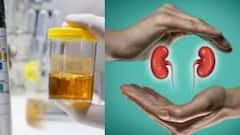 Kidney Damage: પેશાબનો રંગ બદલાઈ ગયો છે તો કિડની થઈ રહી છે ખરાબ, તાત્કાલિક મળો ડૉક્ટરને