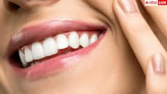 Foods That Cause Cavities: इन चीजों को खाने से दांतों में जल्दी होती है कैविटी, आज ही देख लें पूरी लिस्ट