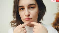 Skin Signs of Internal Disease: स्किन पर ये 9 चीजें दिखें तो गलती से भी मत कर देना इग्नोर, इन साइलेंट बीमारियों का लगता है पता