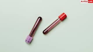 Blood Test Health Risk: ब्लड टेस्ट में छुपा है बीमारी और मौत का खतरा, रिसर्च में चौंकाने वाला दावा