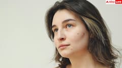 Skin Signs of Internal Disease: स्किन पर ये 9 चीजें दिखें तो गलती से भी मत कर देना इग्नोर, इन साइलेंट बीमारियों का लगता है पता