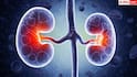 Kidney Disease: अपनी आदतों में कर लें यह आसान-सा बदलाव, कम हो जाएगा किडनी खराब होने का खतरा