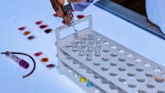 सतना में बच्चों को HIV संक्रमित ब्लड चढ़ाने के मामले में बड़ा एक्शन, ब्लड बैंक प्रभारी समेत 3 निलंबित