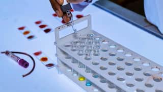 सतना में बच्चों को HIV संक्रमित ब्लड चढ़ाने के मामले में बड़ा एक्शन, ब्लड बैंक प्रभारी समेत 3 निलंबित