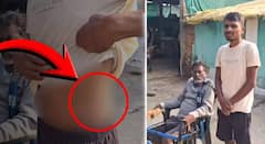 कंबोडिया येथे माझ्यासह आणखी 6 भारतीय लोकांची देखील किडनी काढली; चंद्रपूरातील पीडित शेतकरी रोशन कुडेंचा खळबळजनका दावा