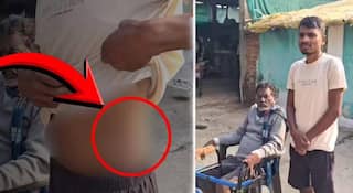 Chandrapur Farmer: कंबोडिया येथे माझ्यासह आणखी 6 भारतीय लोकांची देखील किडनी काढली; पीडित शेतकऱ्याचा खळबळजनका दावा; चौकशीसाठी SITची स्थापना