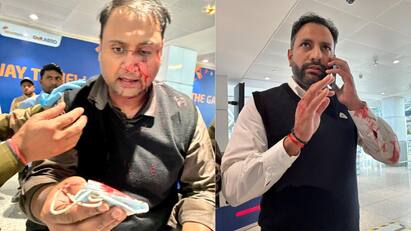 Delhi Police Books Air India Express Pilot For Assaulting Flyer At IGI Airport