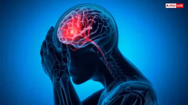 Tension Headache Symptoms: આપણે માથાનો દુખાવો એક કે બે પ્રકારના માનીએ છીએ, જ્યારે મોટાભાગના લોકો તેને ફક્ત એક જ પ્રકારનો માને છે. જોકે, તમને જાણીને આશ્ચર્ય થશે કે એક કે બે નહીં પણ પાંચ પ્રકારના હોય છે.  માથાનો દુખાવો સામાન્ય છે. કેટલાક લોકોને વર્ષમાં એક વાર તેનો અનુભવ થાય છે, જ્યારે કેટલાકને અઠવાડિયામાં એક વાર થાય છે. પરંતુ દરેક માથાનો દુખાવો એકસરખો હોતો નથી. ક્યારેક તે હળવા દબાણ જેવું લાગે છે, ક્યારેક તે ગંભીર માઇગ્રેન હોય છે. માથાના દુખાવાનો પ્રકાર સૂચવી શકે છે કે તે સામાન્ય તણાવયુક્ત માથાનો દુખાવો છે કે કોઈ અંતર્ગત સમસ્યાનું લક્ષણ છે. તેથી, માથાનો દુખાવો સમજવો મહત્વપૂર્ણ છે.