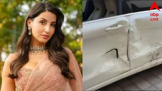 Bollywood News: পথ দুর্ঘটনার কবলে নোরা ফতেহি, চোট পেলেন মাথায়, হল সিটি স্ক্যান, এখন কেমন আছেন নায়িকা?