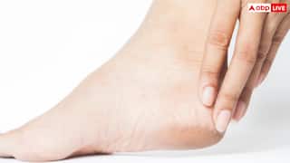 सर्दियों में फट रही हैं आपकी एड़ियां तो न हों परेशान, ये नुस्खे आएंगे बड़े काम