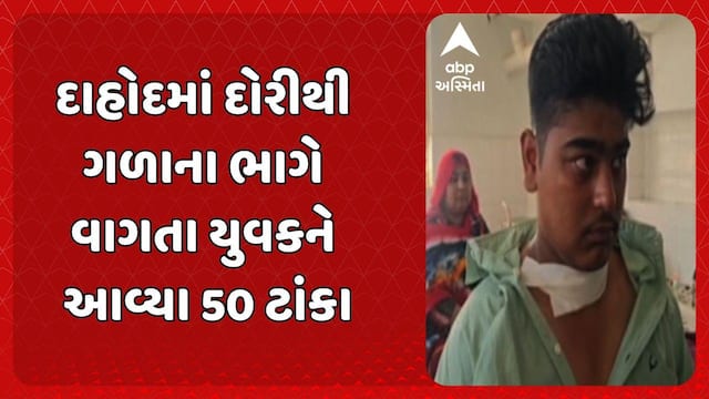 Dahod news: દાહોદમાં ચાઈનીઝ દોરીથી ગળાના ભાગે વાગતા યુવકને આવ્યા 50 ટાંકા