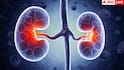 Kidney Disease Symptoms: पेशाब में झाग से लेकर सांस फूलने तक… किडनी की बीमारी के ये संकेत भूलकर भी न करें नजरअंदाज