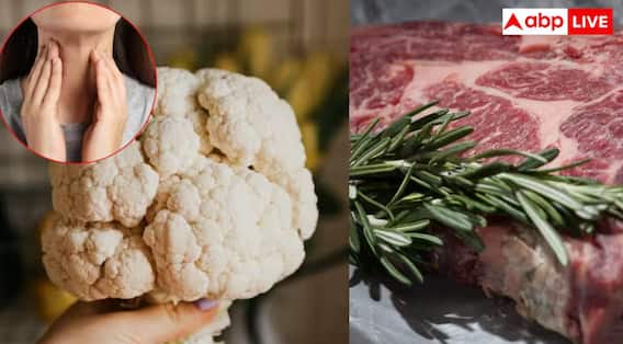 Thyroid ਦੇ ਮਰੀਜ਼ਾਂ ਨੂੰ ਭੁੱਲ ਕੇ ਵੀ ਨਹੀਂ ਖਾਣੀਆਂ ਚਾਹੀਦਾਂ ਆਹ ਚੀਜ਼ਾਂ, ਪਰੇਸ਼ਾਨੀ ਤੋਂ ਬਚਣਾ ਤਾਂ ਕਰ ਲਓ ਨੋਟ