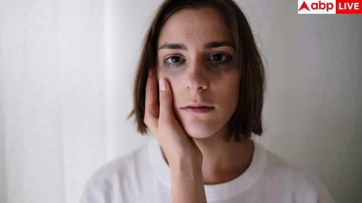 एक्सपर्ट के मुताबिक, चेहरा शरीर के अंदर चल रहे मेटाबॉलिक स्ट्रेस का शुरुआती संकेत बन सकता है. लिवर हार्मोन, टॉक्सिन और न्यूट्रिशयन तत्वों को नियंत्रित करता है, इसलिए इसकी गड़बड़ी त्वचा और नसों में बदलाव के रूप में सामने आती है.