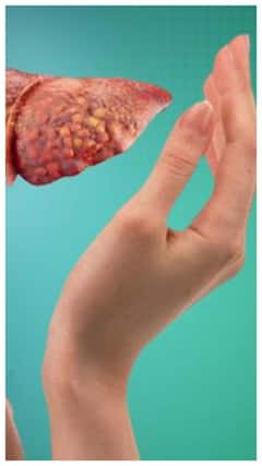 ఇలాంటి అలవాట్లు ఉంటే మీకు ఫ్యాటీ లివర్ ఉన్నట్లే !