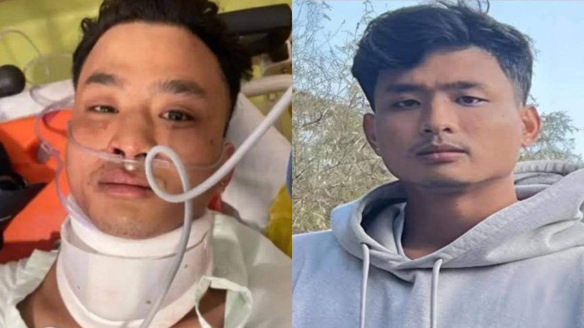 'No Racial Motive' Behind Tripura Student's Killing In Dehradun, Says Police Amid Ongoing Probe