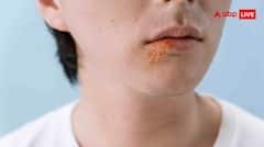 Zoster Infection क्या है? जानें इस वायरल बीमारी की हर एक डिटेल