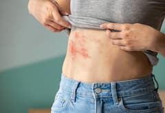 ताप, थकवा अन् प्रायव्हेट..; AIDSची सुरूवातीची लक्षणे कोणती? पुरूषांच्या शरीरावर दिसतात ही '7' लक्षणे, वेळीच ओळखा