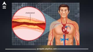 ਕੋਲੈਸਟ੍ਰੋਲ ਵੱਧਣ ਦਾ ਮੁੱਖ ਕਾਰਨ ਕੀ ਹੈ? ਡਾਕਟਰ ਨੇ ਦੱਸੀ High Cholesterol ਦੀ ਅਸਲ ਵਜ੍ਹਾ