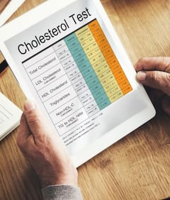 கொலஸ்ட்ரால் பிரச்னையும்.. சமாளிக்க டிப்ஸும்..