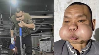 Watch Video: அய்யய்யோ.. தவளை போல மாறிய முகம்.. வைரலாகும் நபர்!