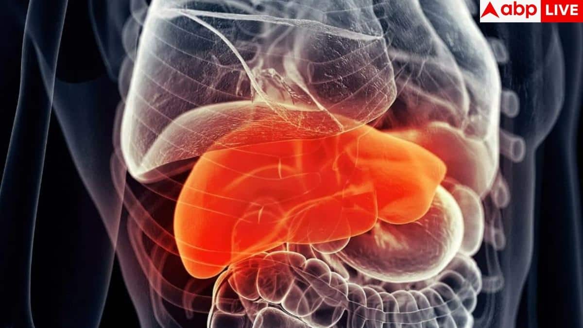 Fatty Liver: इन आदतों की वजह से कैंसर में बदल जाता है फैटी लिवर, जानें इसे रोकने का आसान तरीका