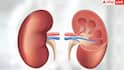 Kidney Damage Signs: हाथ-पैरों पर सबसे पहले दिखते हैं किडनी डैमेज के ये लक्षण, ये 5 साइन तो 99% कर देते हैं इग्नोर