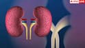 Kidney Damage Signs: हाथ-पैरों पर सबसे पहले दिखते हैं किडनी डैमेज के ये लक्षण, ये 5 साइन तो 99% कर देते हैं इग्नोर
