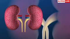 Kidney Damage Signs: हाथ-पैरों पर सबसे पहले दिखते हैं किडनी डैमेज के ये लक्षण, ये 5 साइन तो 99% कर देते हैं इग्नोर