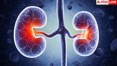 Kidney Damage Signs: हाथ-पैरों पर सबसे पहले दिखते हैं किडनी डैमेज के ये लक्षण, ये 5 साइन तो 99% कर देते हैं इग्नोर