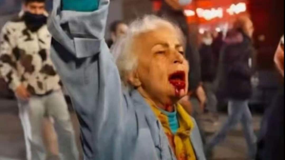 ‘I’m Not Afraid’: ‘Bloodied’ Elderly Woman’s Defiance Goes Viral In Iran Protests: WATCH