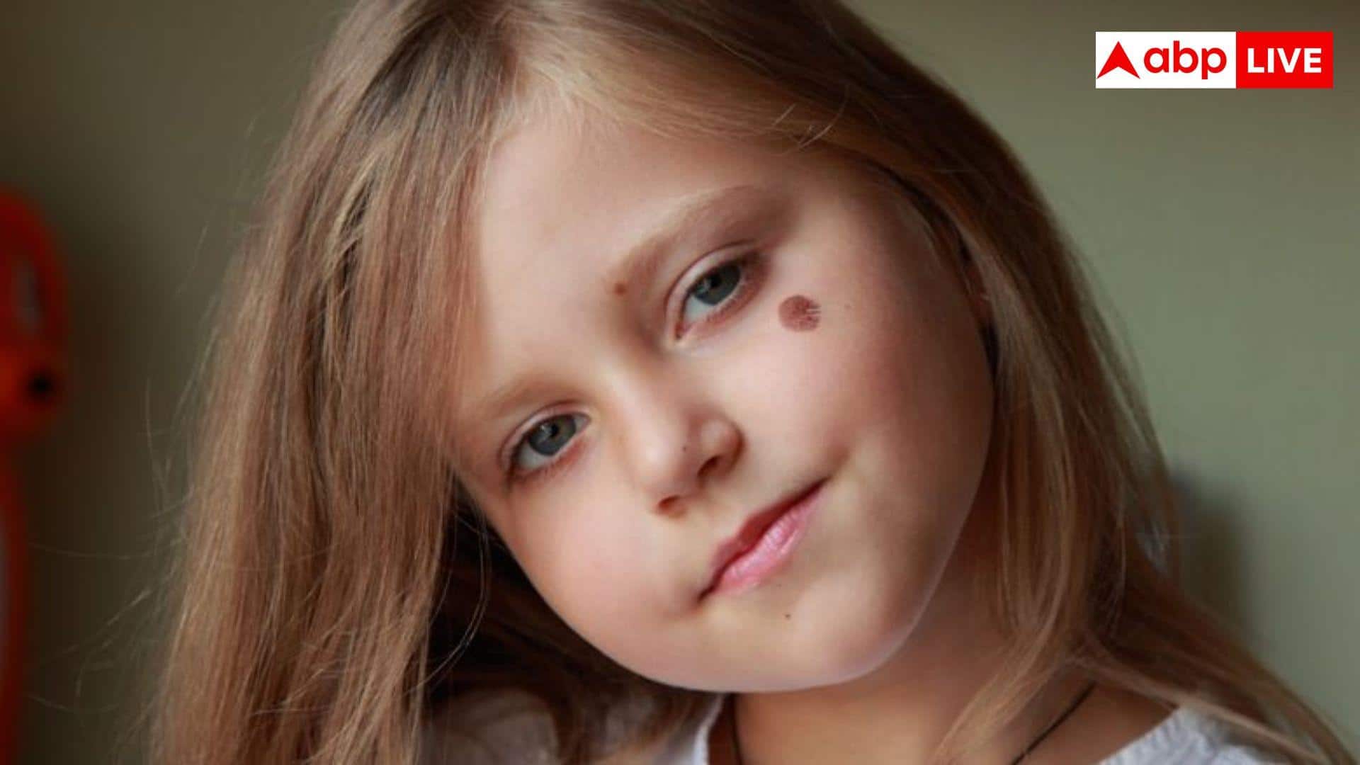 बच्चों के जन्म के समय शरीर पर क्यों होता है जन्मदाग, इसको लेकर डॉक्टर्स क्या बताते हैं?