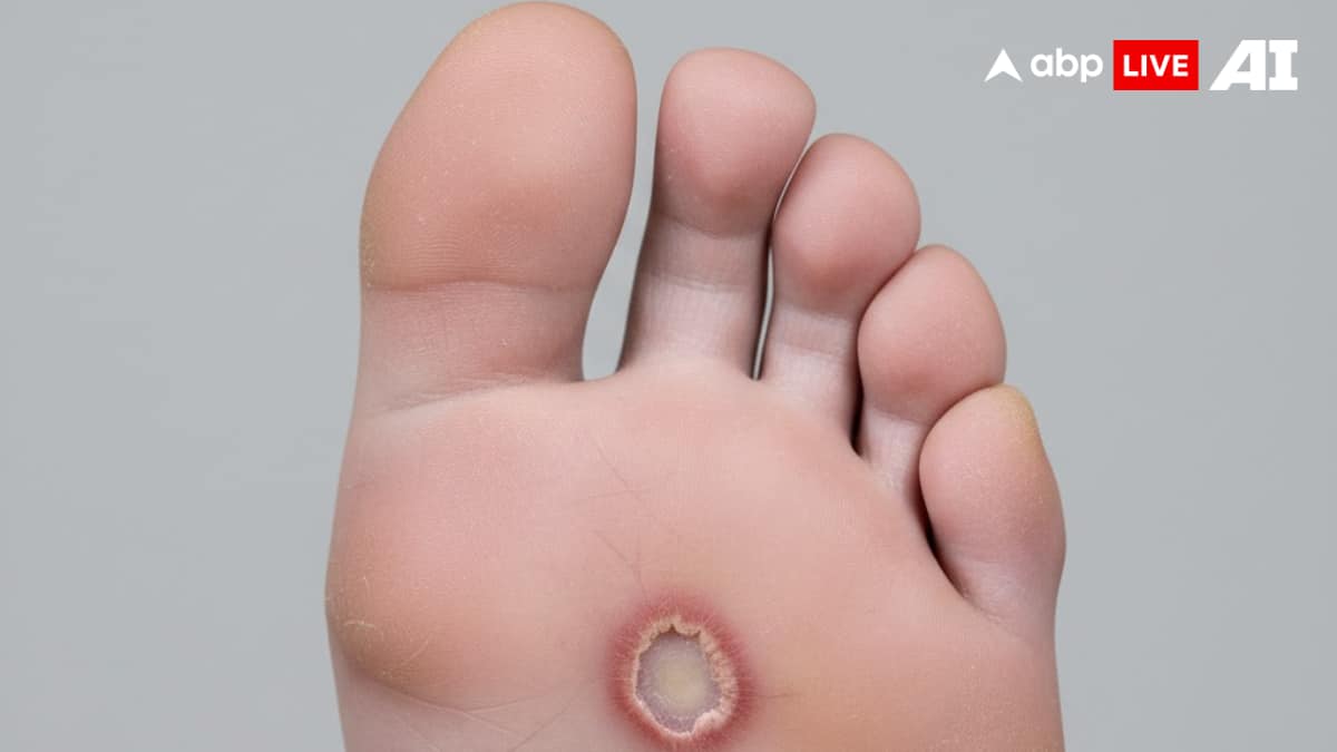 7 Diabetes Skin Symptoms That Signal Uncontrolled Blood Sugar – Don’t Ignore These Warning Signs